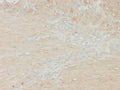 IHC staining of FFPE colon smooth muscle tissue with recombinant MYH11 antibody (clone rMYH11/8066). HIER: boil tissue sections in pH 9 10mM Tris with 1mM EDTA for 20 min and allow to cool before testing.
