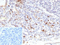 IHC staining of FFPE human tonsil tissue with recombinant IL3RA antibody (clone rIL3RA/9212). Inset: PBS used in place of primary Ab (secondary Ab negative control). HIER: boil tissue sections in pH 9 10mM Tris with 1mM EDTA for 20 min and allow to cool before testing.