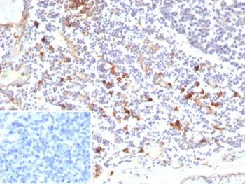 IHC staining of FFPE human tonsil tissue with recombinant IL3RA antibody (clone rIL3RA/9212). Inset: PBS used in place of primary Ab (secondary Ab negative control). HIER: boil tissue sections in pH 9 10mM Tris with 1mM EDTA for 20 min and allow to cool before testing.