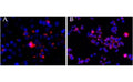 CEP290 antibody (2.5ug/ml) overnight staining of cell lines OPCT-1 [A] and MDA468 [B] with Alexa Fluor 568 [red] and nuclear counter staining with DAPI [blue].