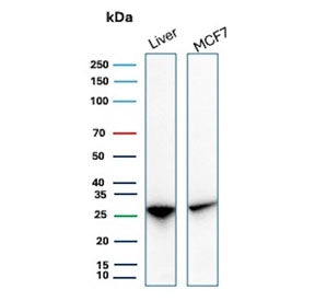 Western blot testing of human liver and MCF7 cell lysate with HSP27 / HSPB1 antibody (clone rHSPB1/7298). Predicted molecular weight: 23-27 kDa.