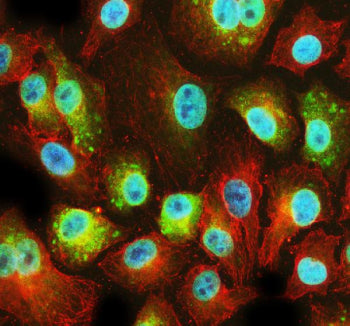 Immunofluorescent staining of PFDN2 using anti-PFDN2 antibody (green) and anti-Beta Tubulin antibody (red). PFDN2 was detected in an immunocytochemical section of cells. Enzyme antigen retrieval was performed using IHC enzyme antigen retrieval reagent for 15 mins. The cells were blocked with 10% goat serum. And then incubated with 5 ug/ml rabbit anti-PFDN2 antibody and mouse anti-Beta Tubulin antibody overnight at 4oC.