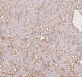 Immunohistochemical staining of PTRHD1 using anti-PTRHD1 antibody. PTRHD1 was detected in a paraffin-embedded section of mouse kidney tissue. Heat mediated antigen retrieval was performed in EDTA buffer (pH 8.0, epitope retrieval solution). The tissue section was blocked with 10% goat serum. The tissue section was then incubated with 2 ug/ml rabbit anti-PTRHD1 antibody overnight at 4oC. Peroxidase Conjugated Goat Anti-rabbit IgG was used as secondary antibody and incubated for 30 min at 37oC.