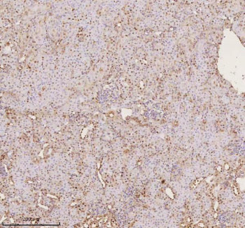 Immunohistochemical staining of PTRHD1 using anti-PTRHD1 antibody. PTRHD1 was detected in a paraffin-embedded section of mouse kidney tissue. Heat mediated antigen retrieval was performed in EDTA buffer (pH 8.0, epitope retrieval solution). The tissue section was blocked with 10% goat serum. The tissue section was then incubated with 2 ug/ml rabbit anti-PTRHD1 antibody overnight at 4oC. Peroxidase Conjugated Goat Anti-rabbit IgG was used as secondary antibody and incubated for 30 min at 37oC.