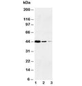 Western blot testing of human 1) Jurkat, 2) Raji and 3) CEM lysate with Caspase-1 antibody at 0.5ug/ml.