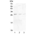 Western blot testing of 1) human placenta, 2) rat brain and 3) mouse brain lysate with IL-34 antibody at 0.5ug/ml. Predicted molecular weight ~26 kDa, secreted as an ~39 kDa homodimer that may be glycosylated.