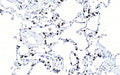 IHC testing of FFPE human lung tissue with SFTPC antibody. HIER: steam section in pH6 citrate buffer for 20 min and allow to cool prior to staining.