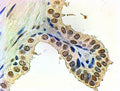 IHC staining of FFPE human prostate with Androgen receptor antibody at 2ug/ml. HIER: steamed with pH6 citrate buffer, AP-staining.