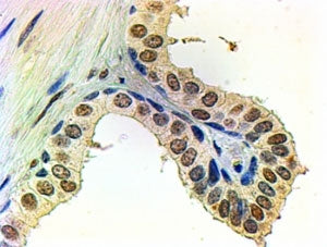 IHC staining of FFPE human prostate with Androgen receptor antibody at 2ug/ml. HIER: steamed with pH6 citrate buffer, AP-staining.