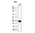 Western blot testing of human liver lysate with SULT1E1 antibody (clone CPTC-SULT1E1-1). Expected molecular weight ~33-35 kDa.