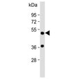 Western blot testing of human kidney lysate with AADC antibody. Predicted molecular weight ~54 kDa.