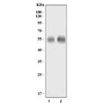 Western blot testing of 1) rat brain and 2) mouse brain lysate with GLAST antibody. Predicted molecular weight: 55-60 kDa.