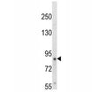 Western blot analysis of TrkA antibody and HepG2 lysate. Observed molecular weight: 85~140 kDa depending on glycosylation level.