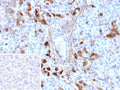 IHC staining of FFPE human pancreas tissue with GC antibody (clone VDBP/9980). Inset: PBS used in place of primary Ab (secondary Ab negative control). HIER: boil tissue sections in pH 9 10mM Tris with 1mM EDTA for 20 min and allow to cool before testing.