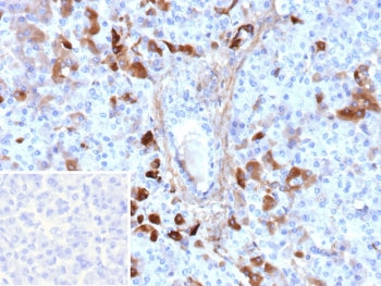 IHC staining of FFPE human pancreas tissue with GC antibody (clone VDBP/9980). Inset: PBS used in place of primary Ab (secondary Ab negative control). HIER: boil tissue sections in pH 9 10mM Tris with 1mM EDTA for 20 min and allow to cool before testing.