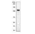 Western blot testing of human K562 cell lysate with CD30 antibody. Predicted molecular weight: 53-120 kDa depending on glycosylation level.