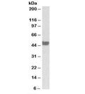 Western blot testing of human colon lysate with CK20 antibody at 0.03ug/ml. Predicted molecular weight: ~49kDa.