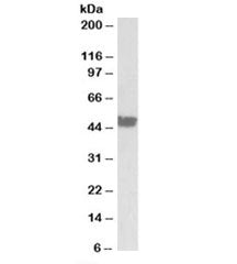 Western blot testing of human colon lysate with CK20 antibody at 0.03ug/ml. Predicted molecular weight: ~49kDa.
