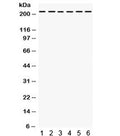 Western blot testing of 1) rat liver, 2) rat kidney, human 3) Jurkat, 4) 22RV1, 5) HepG2, 6) SMMC lysate with Integrin alpha 4 antibody. Predicted molecular weight ~115 kDa, routinely observed at ~150 kDa; observed here at ~220 kDa.