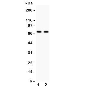 Western blot testing of SHBG antibody and Lane 1: HeLa; 2: COLO320; Predicted size per AA content: 44KD, but this highly glycosylated protein is observed up to 100KD