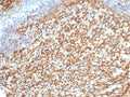 IHC staining of FFPE human tonsil tissue with CD21 antibody (clone CR2/7185R). HIER: boil tissue sections in pH 9 10mM Tris with 1mM EDTA for 20 min and allow to cool before testing.