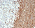 IHC staining of FFPE human brain tissue with GFAP antibody (clone GFAP/6886). HIER: boil tissue sections in pH 9 10mM Tris with 1mM EDTA for 20 min and allow to cool before testing.