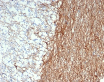 IHC staining of FFPE human brain tissue with GFAP antibody (clone GFAP/6886). HIER: boil tissue sections in pH 9 10mM Tris with 1mM EDTA for 20 min and allow to cool before testing.
