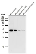 All lanes use the CXCR6 antibody at 1:1000 dilution for 1 hour at room temperature. Predicted molecular weight ~39 kDa.