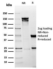 SDS-PAGE analysis of purified, BSA-free recombinant Mesothelin antibody (clone MSLN/6443R) as confirmation of integrity and purity.