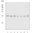 Western blot testing of 1) human PC-3, 2) human HeLa, 3) human HepG2, 4) rat C6, 5) rat PC-12, 6) mouse 4T1 and 7) mouse C2C12 cell lysate with ACP1 antibody. Predicted molecular weight 12-18 kDa (isoforms 1-4).