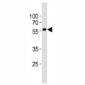 Western blot analysis of lysate from NCCIT cell line using KLF4 antibody at 1:1000. Predicted molecular weight: 50-60 kDa + possible ~75 kDa (phosphorylated form).