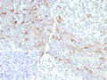 IHC staining of FFPE human tonsil tissue with CD163 antibody (clone rM130/8820). Inset: PBS used in place of primary Ab (secondary Ab negative control). HIER: boil tissue sections in pH 9 10mM Tris with 1mM EDTA for 20 min and allow to cool before testing.
