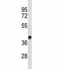 Arg1 antibody western blot analysis in rat liver tissue lysate. Predicted molecular weight ~35kDa.