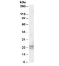Western blot testing of human lung lysate with ARL6 antibody at 0.5ug/ml. Predicted molecular weight: ~22kDa.