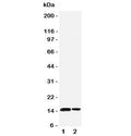 Western blot testing of SUMO1 antibody and Lane 1: rat spleen; 2: human placenta tissue lysate. Predicted molecular weight: 12-15 kDa