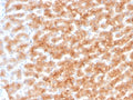 IHC staining of FFPE human liver tissue with Paraoxonase 1 antibody (clone PON1/1351). HIER: boil tissue sections in pH 9 10mM Tris with 1mM EDTA for 20 min and allow to cool before testing.
