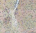 IHC testing of FFPE mouse brain tissue with Otoferlin antibody. HIER: Boil the paraffin sections in pH 8 EDTA buffer for 20 minutes and allow to cool prior to staining.