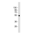 Western blot testing of mouse lung tissue lysate with SLC29A1 antibody.  Predicted molecular weight ~50 kDa.