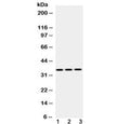 Western blot testing of 1) rat skeletal muscle, 2) mouse heart and 3) human HeLa lysate with Emerin antibody at 0.5ug/ml. Predicted molecular weight 29 kDa but routinely observed at ~34 kDa.