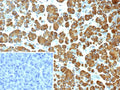 IHC staining of FFPE human pancreas tissue with Pancreatic triacylglycerol lipase antibody (clone PNLIP/9038). Inset: PBS used in place of primary Ab (secondary Ab negative control). HIER: boil tissue sections in pH 9 10mM Tris with 1mM EDTA for 20 min and allow to cool before testing.