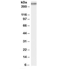 Western blot testing of rat testis lysate with COL7A1 antibody at 0.5ug/ml. Expected molecular weight: 259-300 kDa.