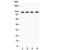 Western blot testing of Neuropilin 1 antibody and Lane 1: (h) U87; 2: (h) A549; 3: human placenta; 4: rat heart lysate. Predicted size: 102~130KD