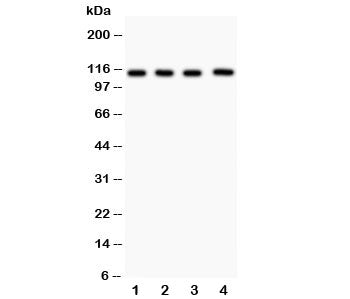 Western blot testing of Neuropilin 1 antibody and Lane 1: (h) U87; 2: (h) A549; 3: human placenta; 4: rat heart lysate. Predicted size: 102~130KD