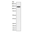Western blot testing of human HeLa cell lysate with recombinant TRIM24 antibody. Expected molecular weight: 117-140 kDa.