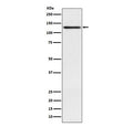 Western blot testing of human A431 cell lysate with Involucrin antibody. Predicted molecular weight ~68 kDa but can be observed at up to ~140 kDa.