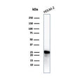 Western blot testing of human HDLM-2 cell lysate with recombinant Bcl-2 antibody. Predicted molecular weight ~26 kDa.