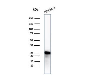 Western blot testing of human HDLM-2 cell lysate with recombinant Bcl-2 antibody. Predicted molecular weight ~26 kDa.