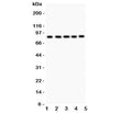 Western blot testing of FOXM1 antibody and Lane 1: HeLa; 2: COLO320; 3: SW620; 4: SKOV; 5: MCD-7. Predicted/observed size ~84KD