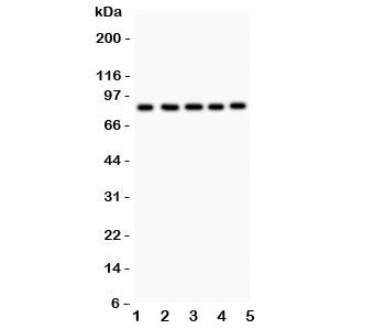Western blot testing of FOXM1 antibody and Lane 1: HeLa; 2: COLO320; 3: SW620; 4: SKOV; 5: MCD-7. Predicted/observed size ~84KD