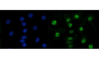 Immunofluorescent staining of FFPE human A549 cells with RAD50 antibody (green) and DAPI nuclear stain (blue). HIER: steam section in pH6 citrate buffer for 20 min.